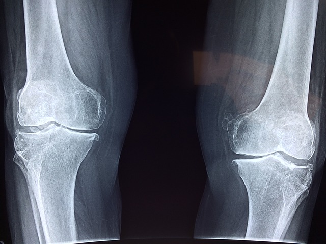 bone x ray injury