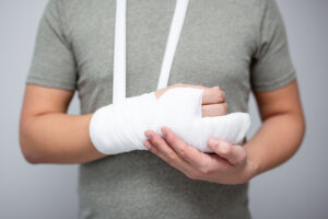 Fracture And First Aid Concept - Close Up Of Male Hand With Band