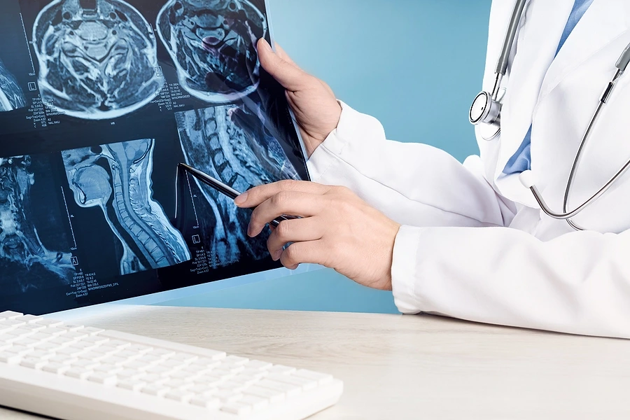 Long-Term Care Planning After a Brain Injury